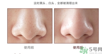 yu.r巧克力棒鼻貼怎么樣？yu.r巧克力鼻貼好用嗎？