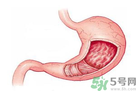 緩解胃脹的方法是什么？胃脹可以吃什么？
