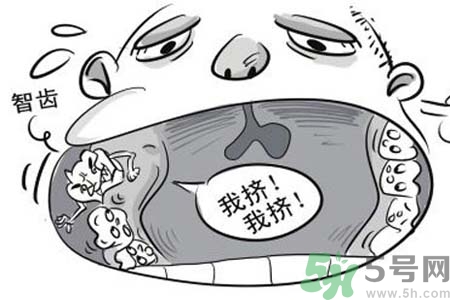 智齒一定要拔掉嗎？什么樣的智齒可以不拔？