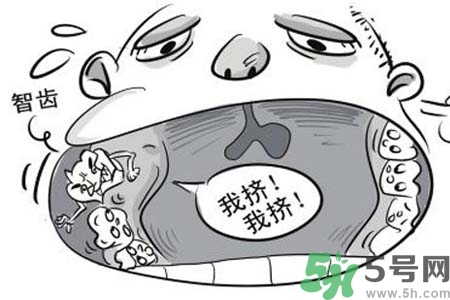 智齒橫著長(zhǎng)怎么辦？智齒橫著長(zhǎng)一定要拔了嗎？