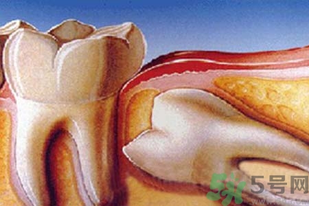 拔智齒一顆多少錢？拔除智齒收費多少？