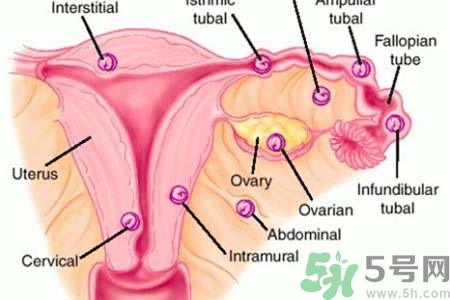 宮外孕手術(shù)后吃什么好？宮外孕手術(shù)后需要注意什么？