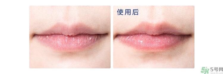 碧唇小藍(lán)罐唇膏孕婦可以用嗎？blistex碧唇小藍(lán)罐專柜價(jià)格