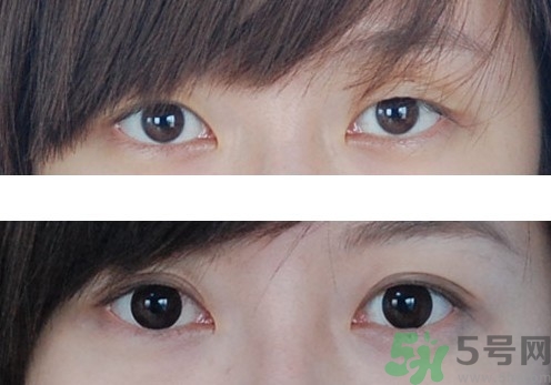 雙眼皮貼怎么貼最自然？雙眼皮貼貼久了會(huì)變雙眼皮嗎？