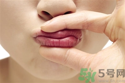 孕婦嘴唇干裂脫皮怎么回事？孕婦嘴唇干裂脫皮是缺什么