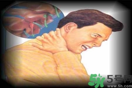 肩頸痛怎么回事？肩頸痛怎么辦？