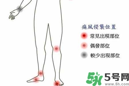 引發(fā)痛風(fēng)的原因是什么？痛風(fēng)病人飲食需注意什么好？