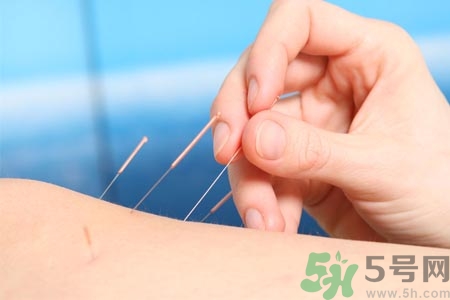 針灸一次要扎多長(zhǎng)時(shí)間？針灸可以幾天做一次？