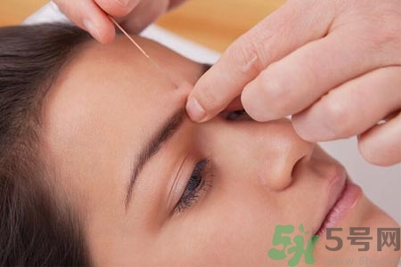 針灸一次要扎多長(zhǎng)時(shí)間？針灸可以幾天做一次？