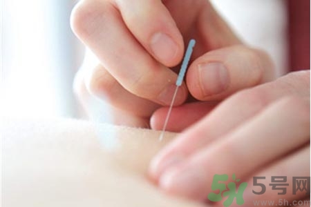 針灸一次要扎多長(zhǎng)時(shí)間？針灸可以幾天做一次？