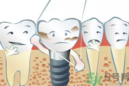 牙線對牙齒好嗎？牙線怎么正確使用？