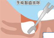 智齒拔完后有個(gè)洞怎么辦？拔智齒后有個(gè)洞多久能長好？