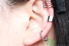 過敏體質(zhì)能打耳洞嗎？疤痕體質(zhì)可以穿耳洞嗎？