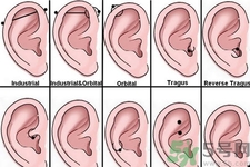 過敏體質(zhì)能打耳洞嗎？疤痕體質(zhì)可以穿耳洞嗎？