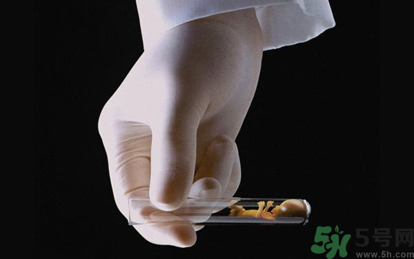 做試管嬰兒要多長(zhǎng)時(shí)間？做試管嬰兒可以選擇性別？