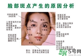 色斑會(huì)自己消失嗎？色斑遺傳嗎？