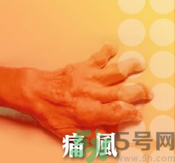 骨關(guān)節(jié)炎能治好嗎？骨關(guān)節(jié)炎平時注意事項(xiàng)