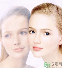 曬斑可以自己消退嗎？曬斑可以用激光去除嗎？