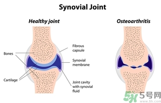 類風(fēng)濕關(guān)節(jié)炎的診斷標(biāo)準(zhǔn) 類風(fēng)濕關(guān)節(jié)炎的飲食選擇與禁忌 類風(fēng)濕關(guān)節(jié)炎的診斷標(biāo)準(zhǔn) 類風(fēng)濕關(guān)節(jié)炎的飲食選擇與禁忌