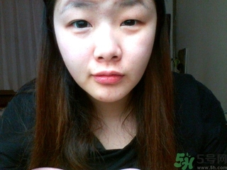 天生腫眼泡怎么消除？天生腫眼泡怎么辦？