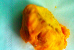 雞蛋果怎么吃？雞蛋果的籽可以吃嗎？