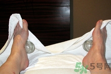 腳底可以拔罐嗎？腳底拔火罐有什么好處？