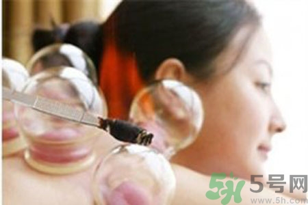 肩膀酸痛可以拔火罐嗎？孕婦肩膀酸痛能拔火罐嗎？