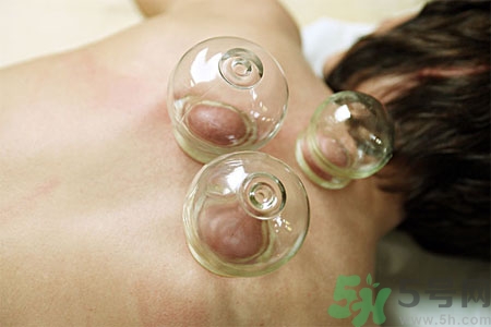 肩膀酸痛可以拔火罐嗎？孕婦肩膀酸痛能拔火罐嗎？