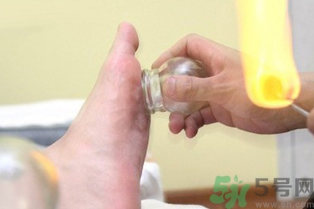 腳底拔罐能去濕氣嗎？腳底拔罐出現(xiàn)青紫正常嗎？