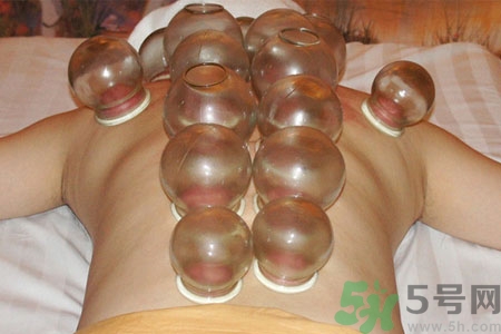 老人能在家拔火罐嗎？老年人拔火罐需要注意什么？