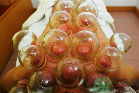 老人能在家拔火罐嗎？老年人拔火罐需要注意什么？