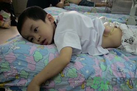 小孩可以拔罐嗎？寶寶能拔火罐嗎？