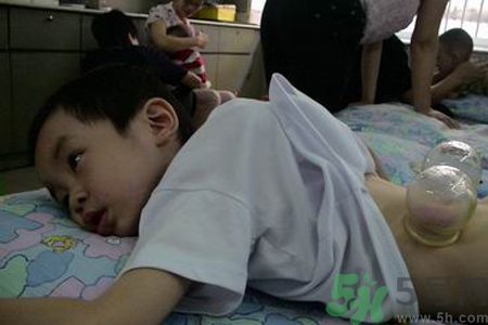 小孩可以拔罐嗎？寶寶能拔火罐嗎？