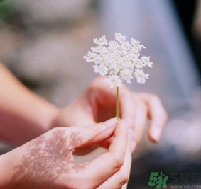 手指被門夾了有淤血怎么辦？手指被門夾了有淤血怎么處理？