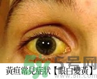 上腹部不舒服有時疼痛會不會是胰臟癌？