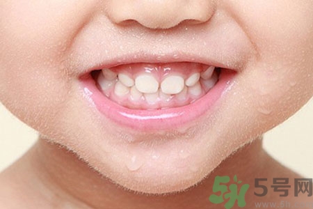 小孩牙齒發(fā)黑怎么回事？小孩牙齒發(fā)黑怎么辦？