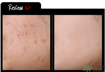 w.lab雪花氣墊黑色款怎么樣？w.lab雪花氣墊黑色和白色區(qū)別？