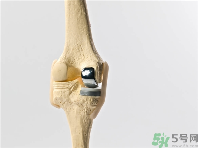 膝關(guān)節(jié)疼痛是怎么回事該怎么辦？膝關(guān)節(jié)疼痛如何治療？