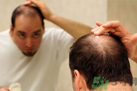 掉頭發(fā)需要檢查什么？脫發(fā)需要做什么檢查？