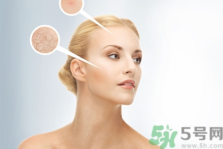 甘油會堵塞毛孔嗎？甘油堵塞毛孔怎么辦？