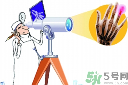 什么年齡測骨齡最好？如何測骨齡？