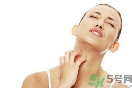 臉過敏發(fā)紅癢怎么辦？臉過敏發(fā)紅癢擦什么藥好？