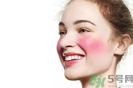 臉過敏發(fā)紅癢怎么辦？臉過敏發(fā)紅癢擦什么藥好？