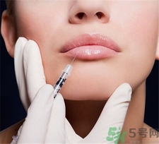 自體脂肪豐唇多久恢復(fù)?自體脂肪豐唇能維持多久? 自體脂肪豐唇多久恢復(fù)?自體脂肪豐唇能維持多久?