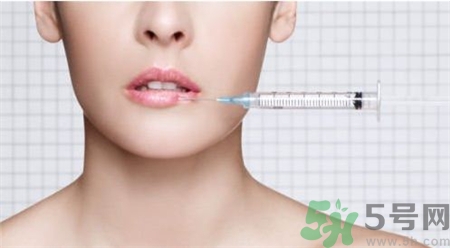 玻尿酸豐唇后多久消腫?玻尿酸豐唇后多久變軟? 玻尿酸豐唇后多久消腫?玻尿酸豐唇后多久變軟?