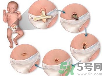 新生兒肚臍可以碰水嗎？新生兒肚臍沒脫落能洗澡嗎？