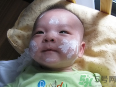 新生兒濕疹可以用爐甘石洗劑嗎？新生兒濕疹的護(hù)理措施