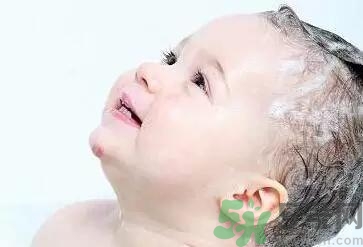 寶寶頭垢是如何產(chǎn)生的？寶寶頭垢怎么去掉？