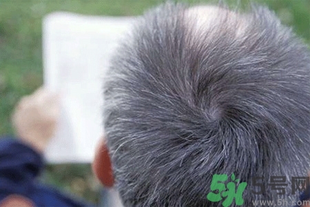 缺什么頭發(fā)會變白？年輕人頭發(fā)變白是缺維生素嗎？