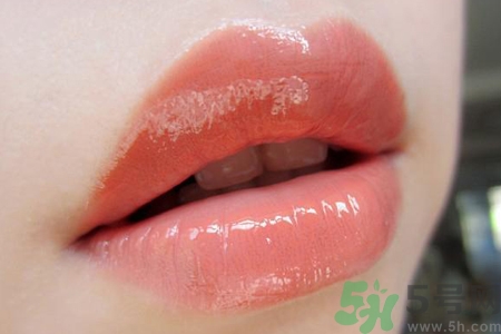 嘴巴周圍干燥起皮發(fā)紅怎么回事？嘴巴周圍干燥起皮怎么辦？